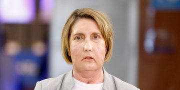 primer trasplante cara donante eutanasia vall hebron barcelona