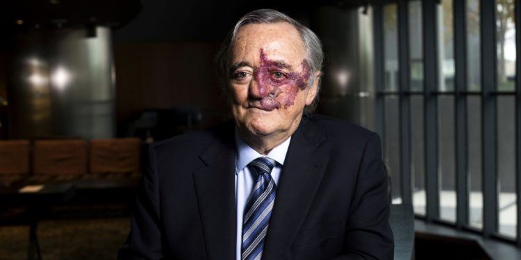 Mariano Barbacid asegura que el nuevo tratamiento dirigido contra el cáncer de páncreas duplica la supervivencia sin quimioterapia