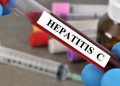 España, más cerca de eliminar la hepatitis C: el reto es encontrar a quienes aún no lo saben