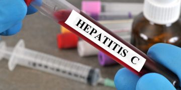 España, más cerca de eliminar la hepatitis C: el reto es encontrar a quienes aún no lo saben
