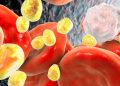 Una terapia contra el colesterol reduce contaminantes PFAS y apunta a un posible efecto sobre los microplásticos