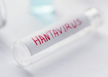 Sanidad confirma un caso de hantavirus Andes en un turista que se encuentra aislado en Galicia