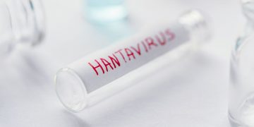 Sanidad confirma un caso de hantavirus Andes en un turista que se encuentra aislado en Galicia