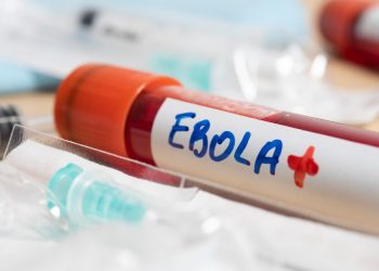 El brote de ébola en la República Democrática del Congo supera los 4.000 casos y deja 1.850 muertos