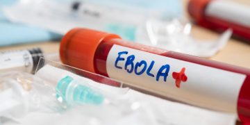 El brote de ébola en la República Democrática del Congo supera los 4.000 casos y deja 1.850 muertos