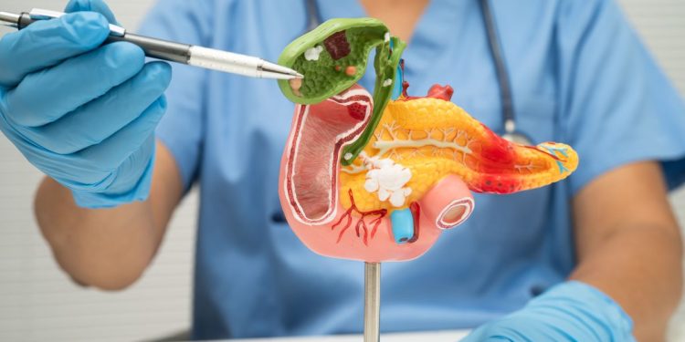 Un nuevo fármaco dirigido consigue duplicar la supervivencia en pacientes con cáncer de páncreas