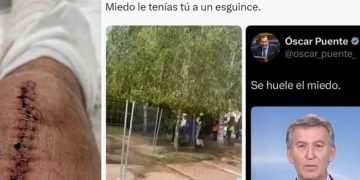 El PP arranca la precampaña electoral mofándose de una lesión del ministro Óscar Puente