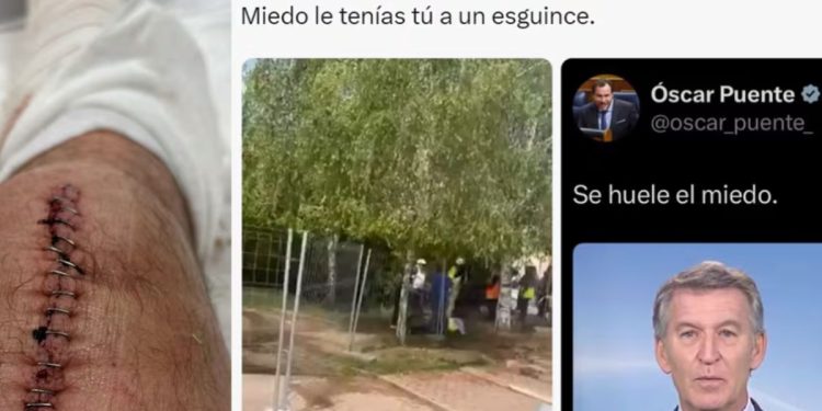 El PP arranca la precampaña electoral mofándose de una lesión del ministro Óscar Puente